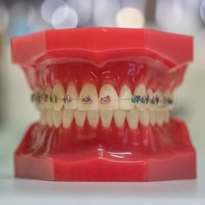 Model of human teeth with colorful braces, showcasing dental care and orthodontics.